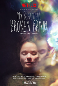 My Beautiful Broken Brain Streaming VF Français Complet Gratuit
